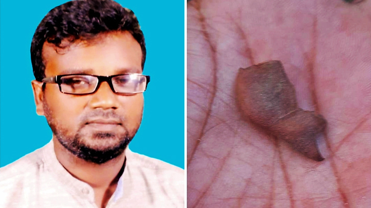 পরকীয়া প্রেমিকার ঘরে ঢুকে কান হারালেন ইউনিয়ন আওয়ামী লীগ নেতা পরকীয়া প্রেমিকার ঘরে ঢুকে কান হারালেন ইউনিয়ন আওয়ামী লীগ নেতা