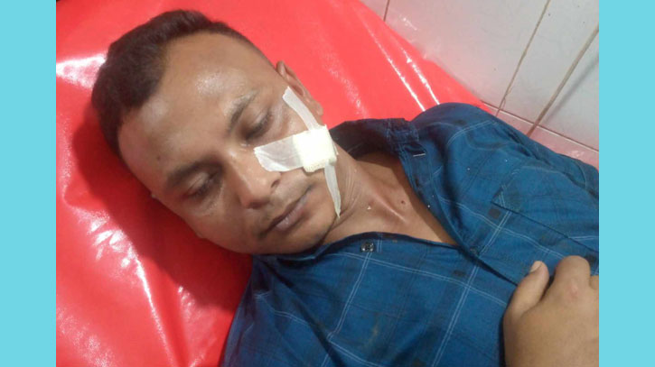 চাঁদা না পেয়ে ছাত্রদল নেতাকে ছুরিকাঘাত করলেন বিএনপি নেতা চাঁদা না পেয়ে ছাত্রদল নেতাকে ছুরিকাঘাত করলেন বিএনপি নেতা