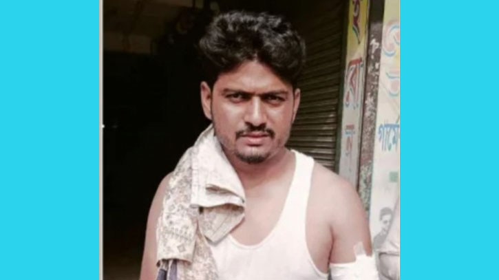 নাটোরে টিসিবি কার্ড বিতরণ নিয়ে বিএনপির দুপক্ষের সংঘর্ষ, গুলিবিদ্ধ ১ নাটোরে টিসিবি কার্ড বিতরণ নিয়ে বিএনপির দুপক্ষের সংঘর্ষ, গুলিবিদ্ধ ১