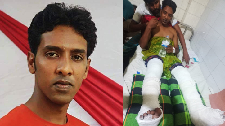 চাটমোহরে যুবদল নেতাকে রড দিয়ে পিটিয়ে আহত করেছে সন্ত্রাসীরা চাটমোহরে যুবদল নেতাকে রড দিয়ে পিটিয়ে আহত করেছে সন্ত্রাসীরা