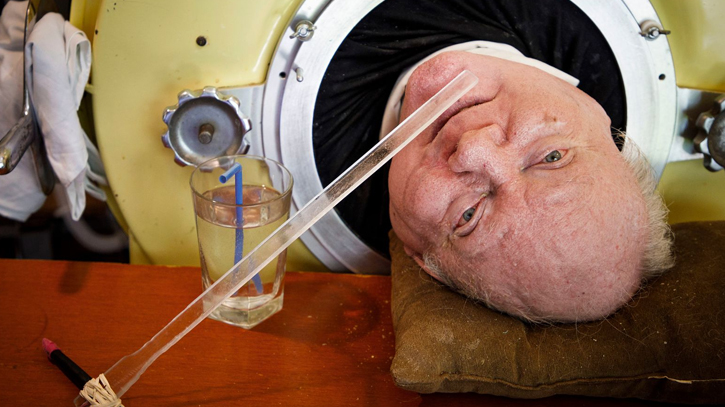 ‘The Man in the Iron Lung’, dies at 78 ‘The Man in the Iron Lung’, dies at 78